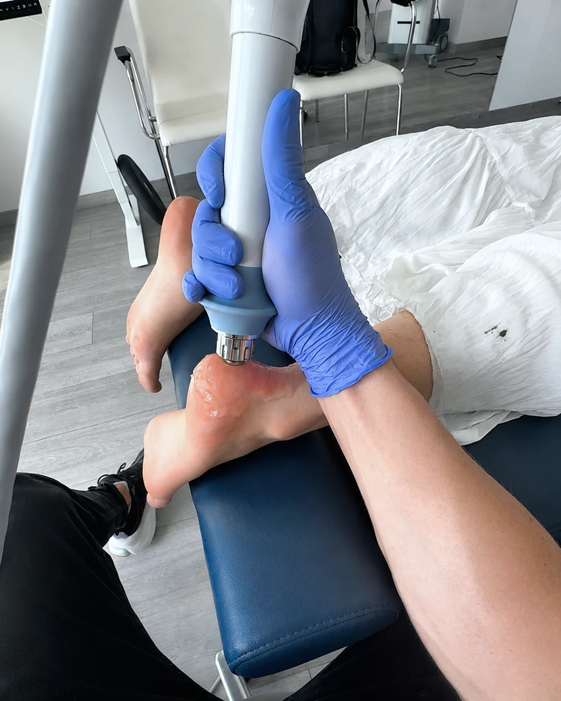 Shockwave therapy treatment for the foot at Confido